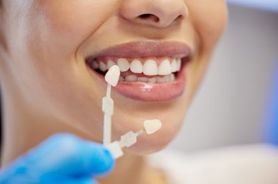 Modern dental treatment